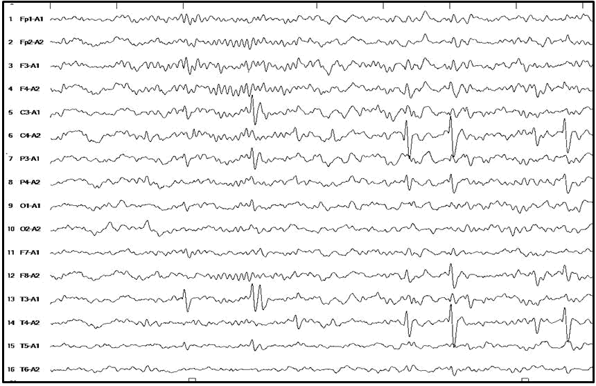 current-pediatric-spikes