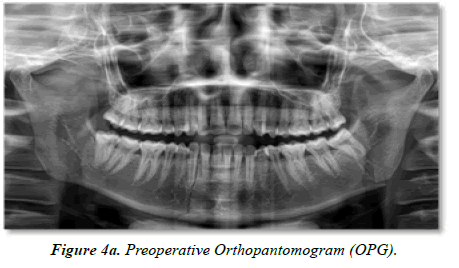 Oral-Medicine-Orthopantomogram