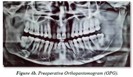 Oral-Medicine-Preoperative