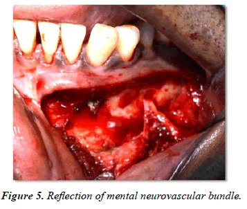 Oral-Medicine-neurovascular
