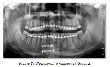 Oral-Medicine-radiograph