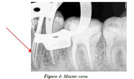 clinical-dentistry-cone