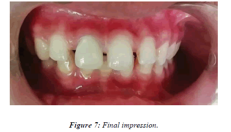 clinical-dentistry-impression