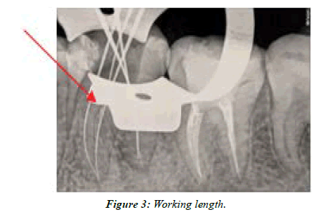 clinical-dentistry-length