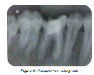 clinical-dentistry-radiograph