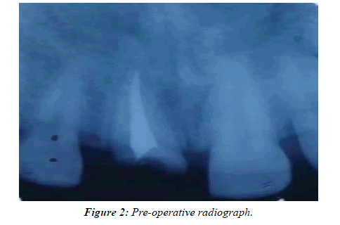 clinical-dentistry-radiograph