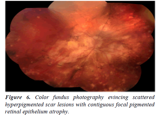 clinical-ophthalmology-fundus