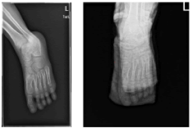 current-pediatrics-foot