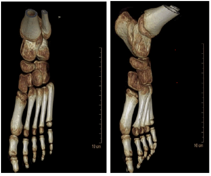 current-pediatrics-foot