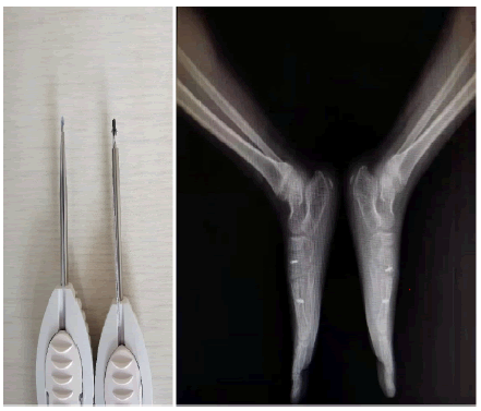 current-pediatrics-foot