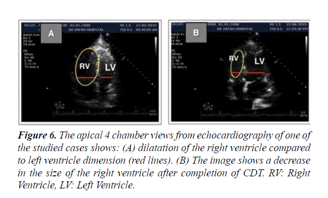 cardiovascular-thoracic-surgery-echocardiography