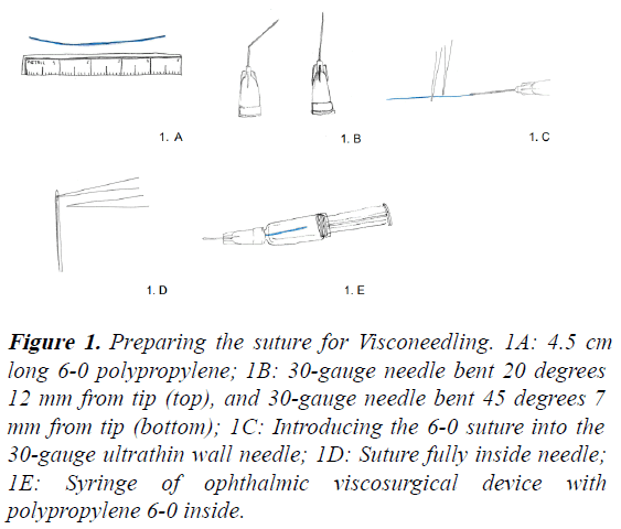 clinical-ophthalmology-Visconeedling