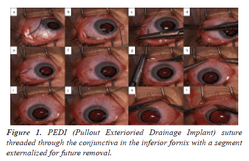 clinical-ophthalmology-fornix