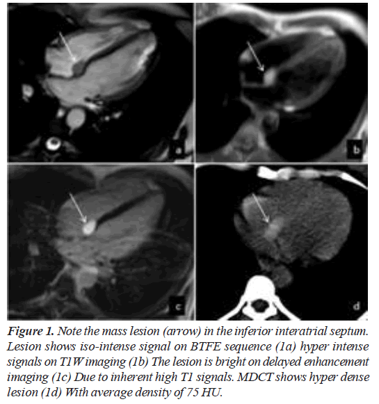 current-cardiology-Lesion