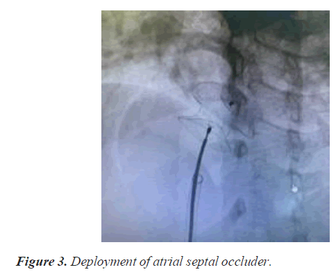 current-cardiology-atrial