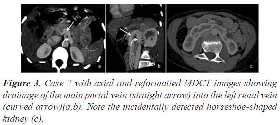 current-cardiology-axial