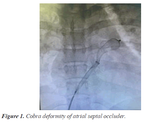 current-cardiology-deformity