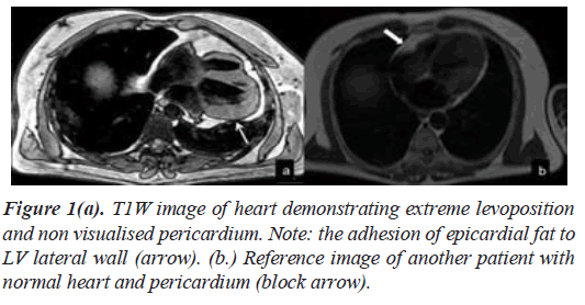 current-cardiology-heart