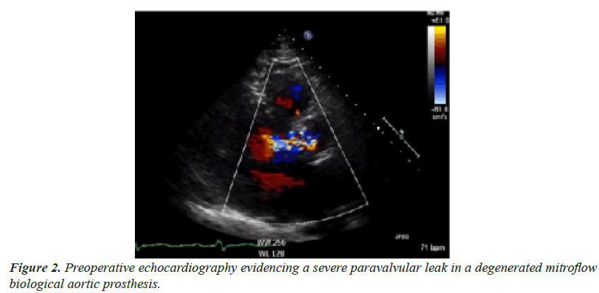 current-cardiology-mitroflow