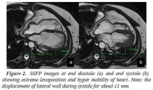 current-cardiology-mobility