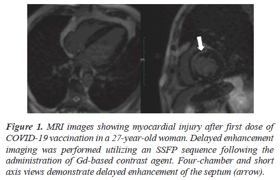 current-cardiology-myocardial