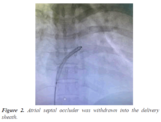 current-cardiology-occluder