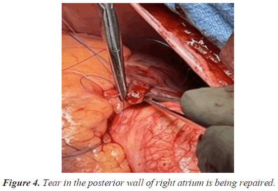 current-cardiology-posterior