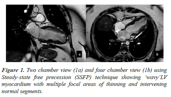 current-cardiology-technique