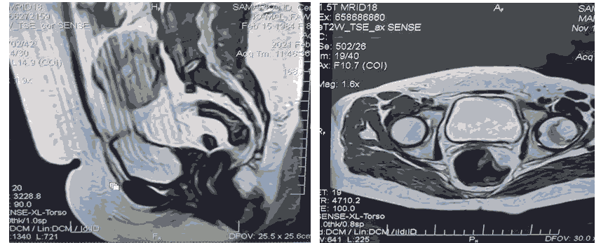 current-pediatric-pelvis