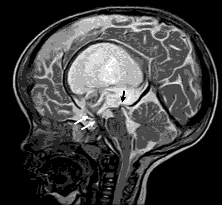 current-pediatric-sagittal