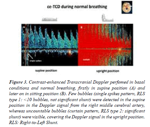 current-trends-cardiology-Doppler