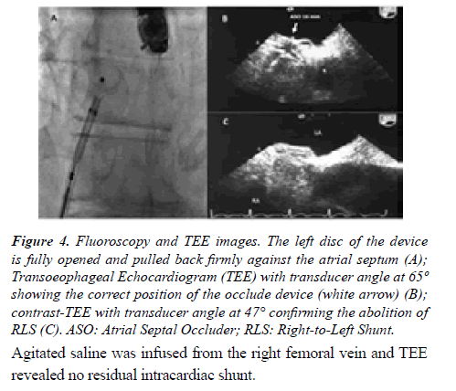 current-trends-cardiology-Fluoroscopy