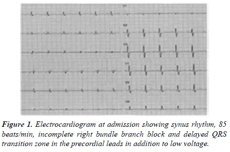 current-trends-cardiology-electrocardiogram