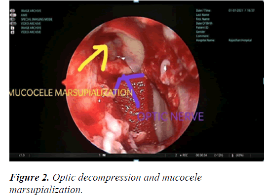 experimental-toxicology-mucocele