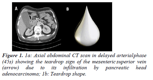 abdominal