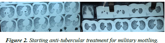 international-respiratory-medicine-anti-tubercular