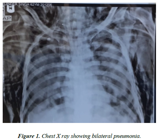 international-respiratory-medicine-chest-x-ray