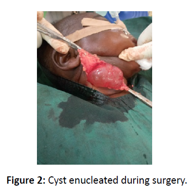 otolaryngology-online-journal-surgery