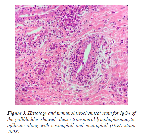 AAAJMR-eosinophill