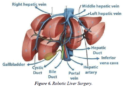 Cancer-Clinical-Liver