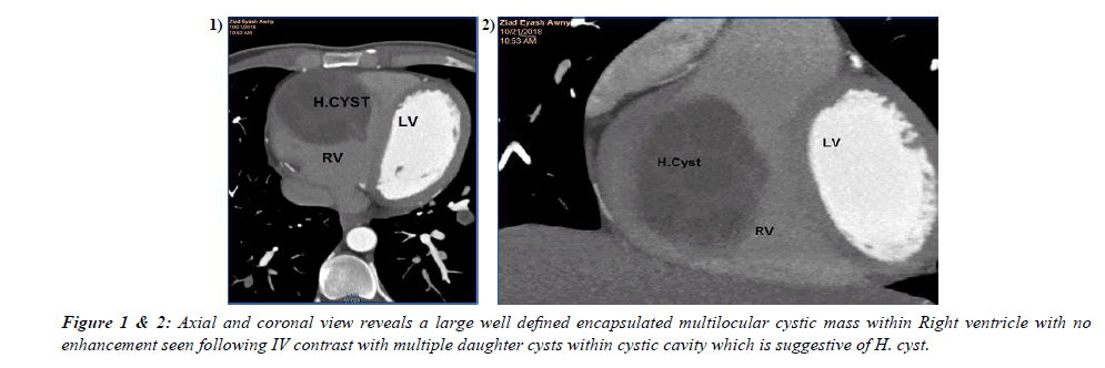 Cardiovascular-Medicine-Axial