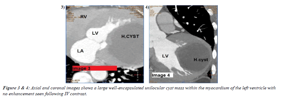 Cardiovascular-Medicine-coronal