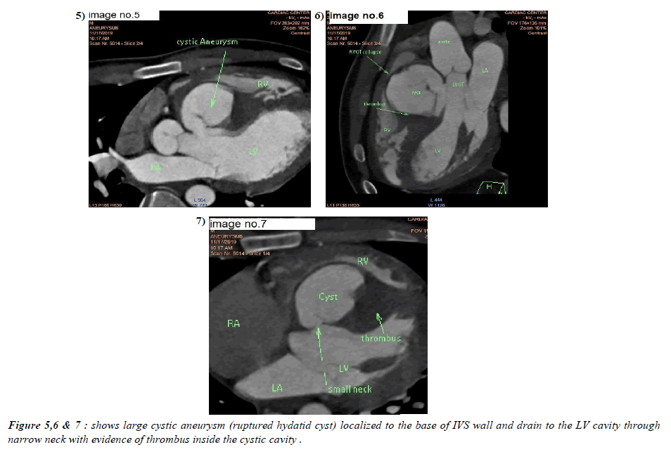 Cardiovascular-Medicine-cystic