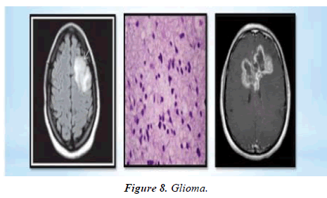 Material-Science-Glioma