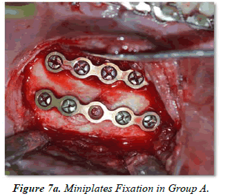 Oral-Medicine-Fixation