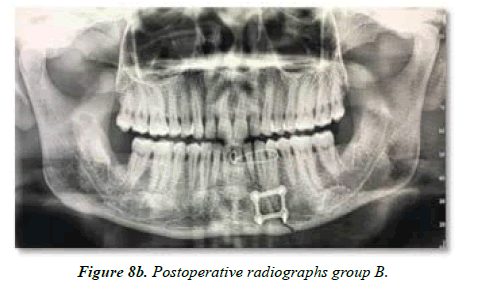 Oral-Medicine-Postoperative