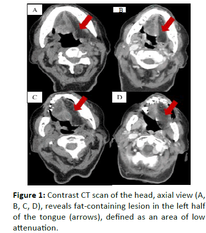 Otolaryngology-axial