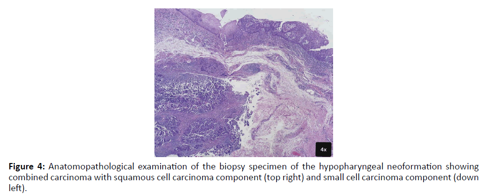 Otolaryngology-component