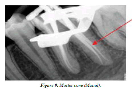 clinical-dentistry-Mesial