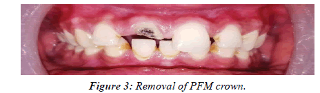 clinical-dentistry-crown